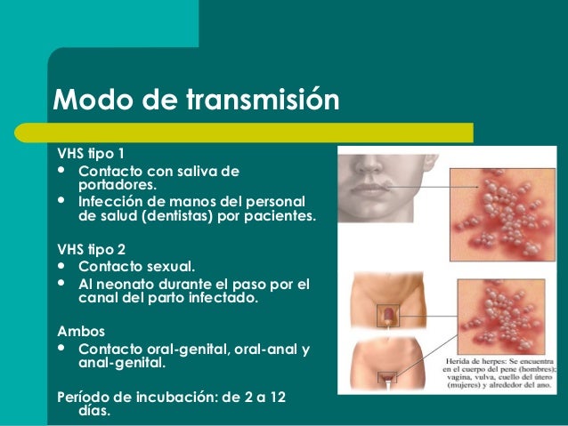Emfermedades del sexo anal pics 387